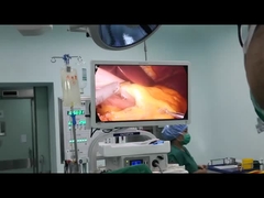 Cirurgia de Bariatic